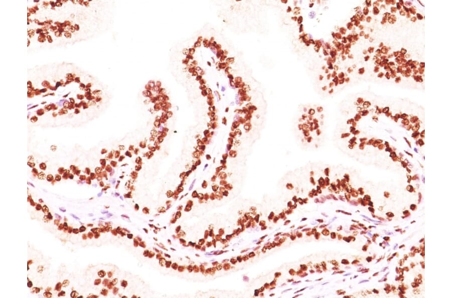 Immunohistochemistry - Anti-Androgen Receptor Antibody [AR441 + DHTR/882] - BSA and Azide free (A252235) - Antibodies.com