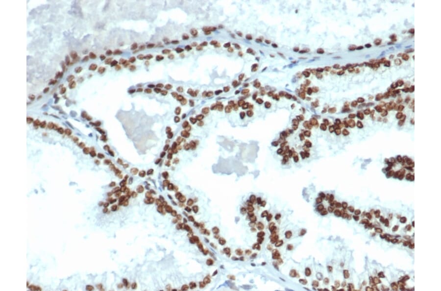 Immunohistochemistry - Anti-Androgen Receptor Antibody [DHTR/4445R] - BSA and Azide free (A252237) - Antibodies.com