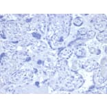 Immunohistochemistry - Anti-Androgen Receptor Antibody [DHTR/4445R] - BSA and Azide free (A252236) - Antibodies.com