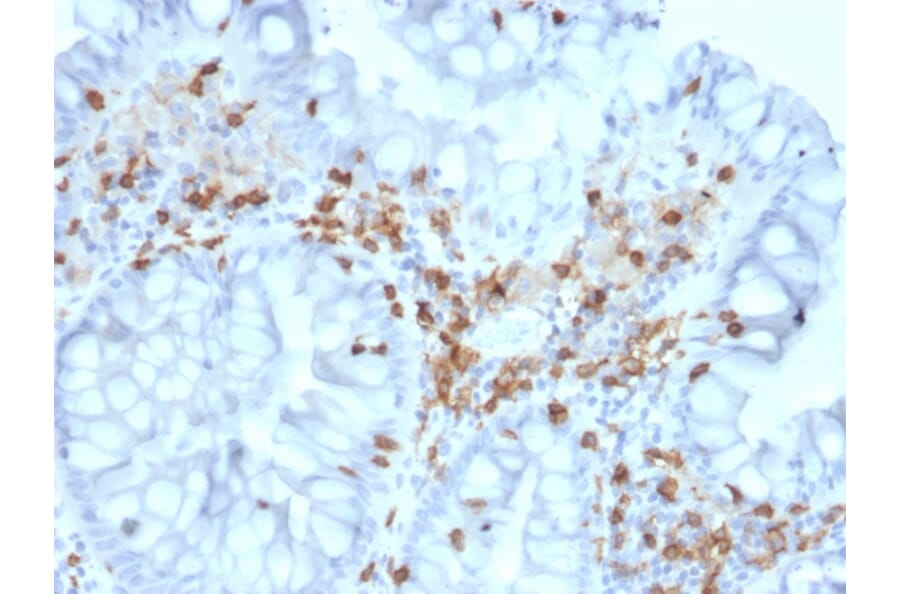 Immunohistochemistry - Anti-Integrin alpha E Antibody [ITGAE/2063] - BSA and Azide free (A252238) - Antibodies.com