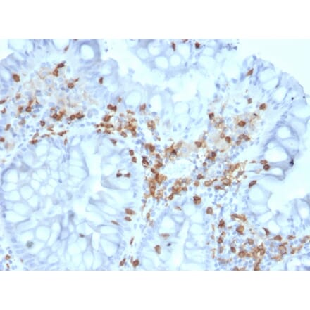 Immunohistochemistry - Anti-Integrin alpha E Antibody [ITGAE/2063] - BSA and Azide free (A252238) - Antibodies.com