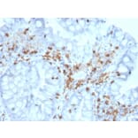 Immunohistochemistry - Anti-Integrin alpha E Antibody [ITGAE/2063] - BSA and Azide free (A252238) - Antibodies.com