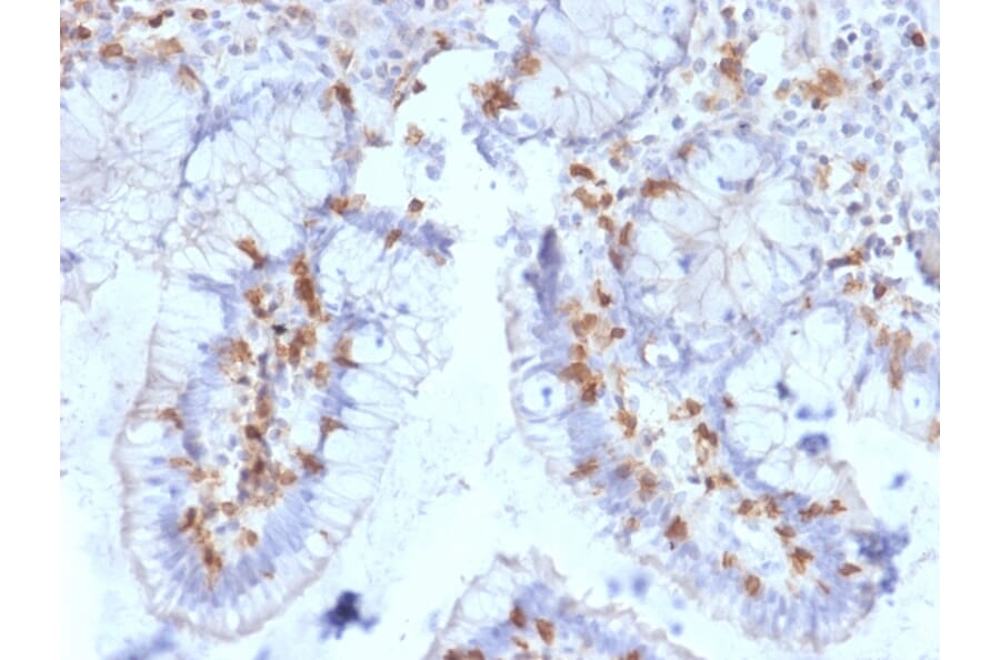 Immunohistochemistry - Anti-Integrin alpha E Antibody [ITGAE/2063] - BSA and Azide free (A252238) - Antibodies.com
