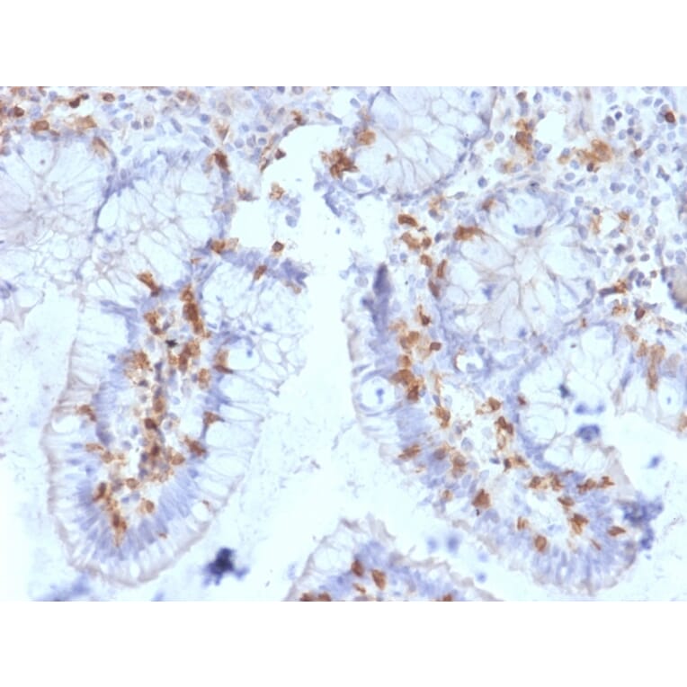Immunohistochemistry - Anti-Integrin alpha E Antibody [ITGAE/2063] - BSA and Azide free (A252238) - Antibodies.com
