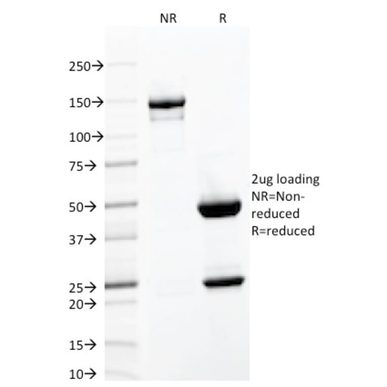 SDS-PAGE - Anti-Integrin alpha E Antibody [ITGAE/2063] - BSA and Azide free (A252238) - Antibodies.com
