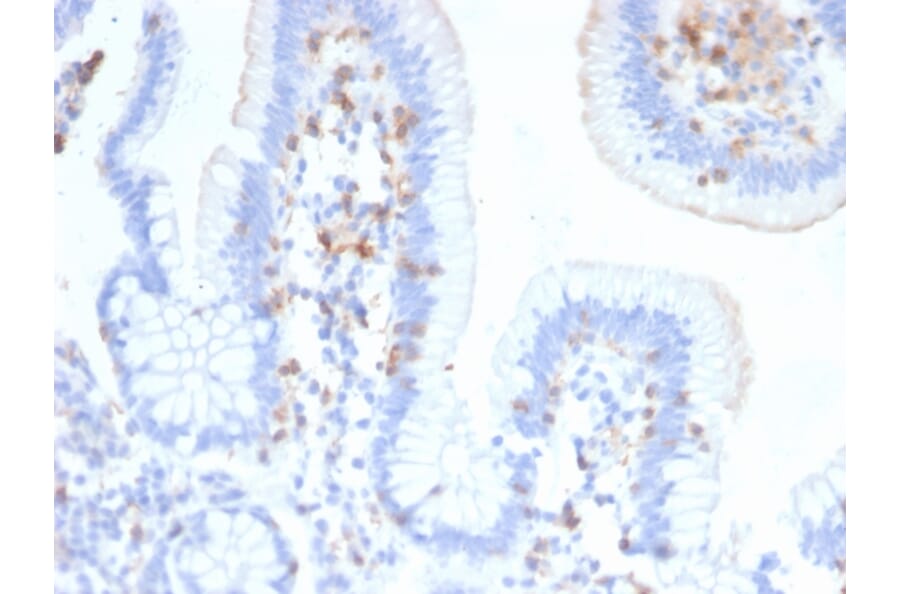 Immunohistochemistry - Anti-Integrin alpha E Antibody [ITGAE/2474] - BSA and Azide free (A252239) - Antibodies.com