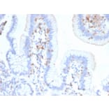 Immunohistochemistry - Anti-Integrin alpha E Antibody [ITGAE/2474] - BSA and Azide free (A252239) - Antibodies.com