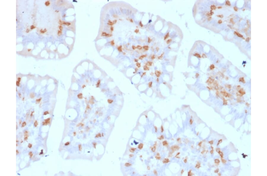 Immunohistochemistry - Anti-Integrin alpha E Antibody [ITGAE/2474] - BSA and Azide free (A252239) - Antibodies.com
