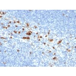 Immunohistochemistry - Anti-Integrin alpha E Antibody [ITGAE/2474] - BSA and Azide free (A252239) - Antibodies.com