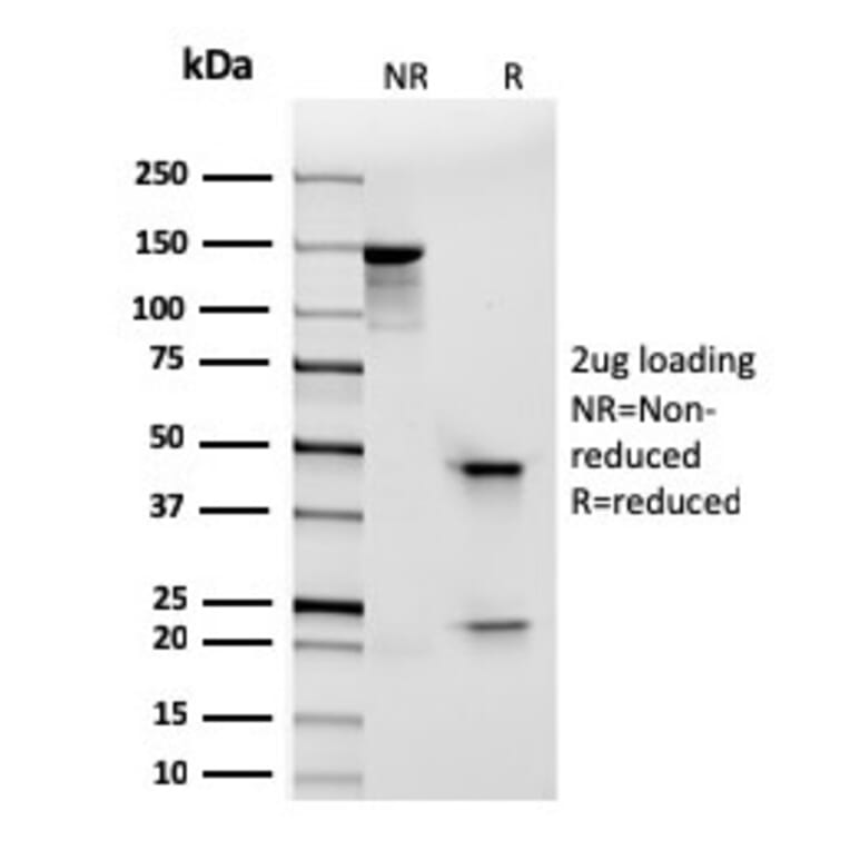 SDS-PAGE - Anti-Integrin alpha E Antibody [rITGAE/2063] - BSA and Azide free (A252240) - Antibodies.com