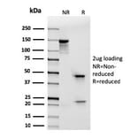 SDS-PAGE - Anti-Integrin alpha E Antibody [rITGAE/2063] - BSA and Azide free (A252240) - Antibodies.com