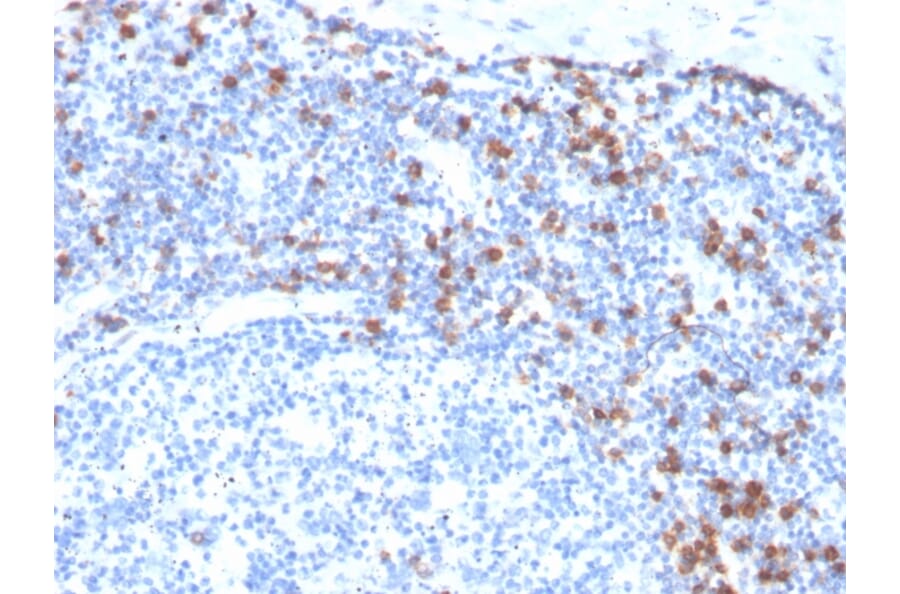 Immunohistochemistry - Anti-Integrin alpha E Antibody [ITGAE/3904R] - BSA and Azide free (A252240) - Antibodies.com
