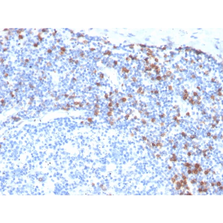 Immunohistochemistry - Anti-Integrin alpha E Antibody [ITGAE/3904R] - BSA and Azide free (A252240) - Antibodies.com