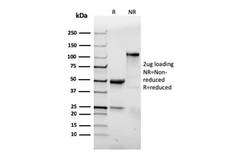 SDS-PAGE - Anti-Integrin alpha E Antibody [ITGAE/3904R] - BSA and Azide free (A252241) - Antibodies.com