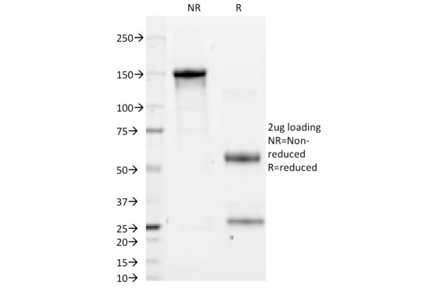 SDS-PAGE - Anti-CD11a Antibody [CRIS-3] - BSA and Azide free (A252242) - Antibodies.com