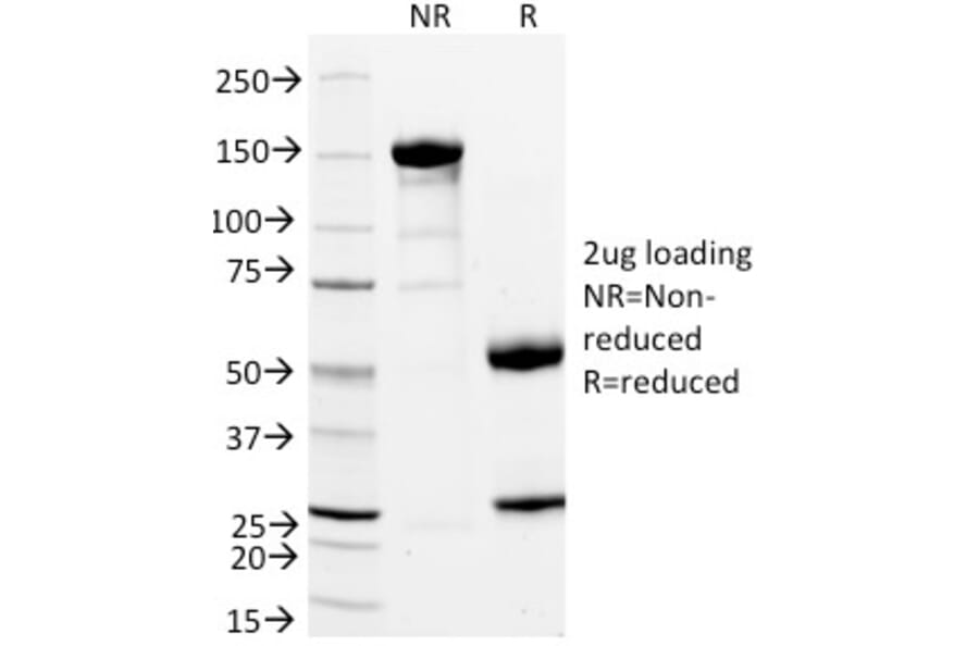 SDS-PAGE - Anti-CD11a Antibody [DF1524] - BSA and Azide free (A252242) - Antibodies.com