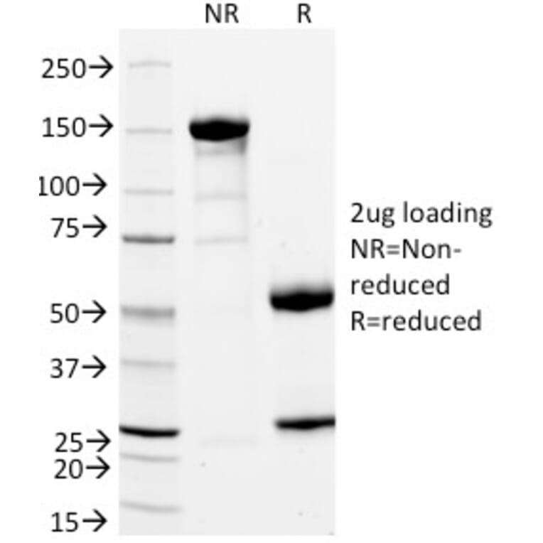 SDS-PAGE - Anti-CD11a Antibody [DF1524] - BSA and Azide free (A252242) - Antibodies.com