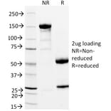 SDS-PAGE - Anti-CD11a Antibody [DF1524] - BSA and Azide free (A252242) - Antibodies.com