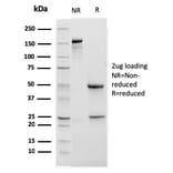 SDS-PAGE - Anti-CD11b Antibody [ITGAM/3338] - BSA and Azide free (A252247) - Antibodies.com