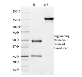 SDS-PAGE - Anti-Integrin alpha V Antibody [ITGAV/1610] - BSA and Azide free (A252248) - Antibodies.com
