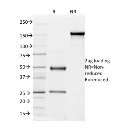 SDS-PAGE - Anti-Integrin alpha V Antibody [ITGAV/1610] - BSA and Azide free (A252248) - Antibodies.com