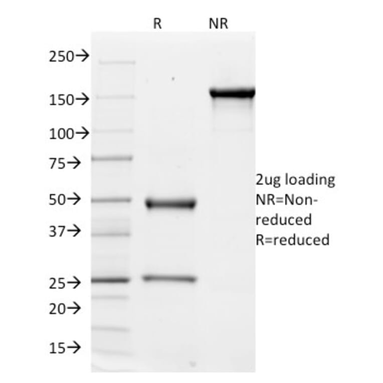 SDS-PAGE - Anti-Integrin alpha V Antibody [ITGAV/1610] - BSA and Azide free (A252248) - Antibodies.com