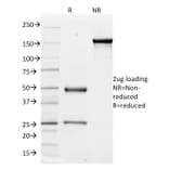 SDS-PAGE - Anti-Integrin alpha V Antibody [ITGAV/1610] - BSA and Azide free (A252248) - Antibodies.com