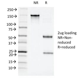 SDS-PAGE - Anti-CD11c Antibody [ITGAX/1243] - BSA and Azide free (A252253) - Antibodies.com