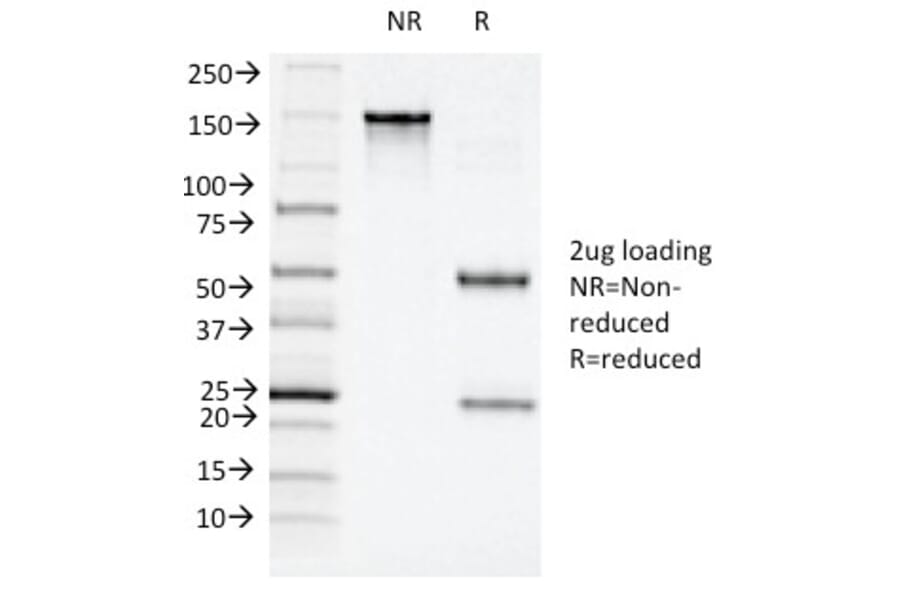 SDS-PAGE - Anti-CD11c Antibody [ITGAX/1243] - BSA and Azide free (A252253) - Antibodies.com