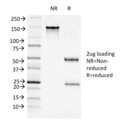 SDS-PAGE - Anti-CD11c Antibody [ITGAX/1243] - BSA and Azide free (A252253) - Antibodies.com