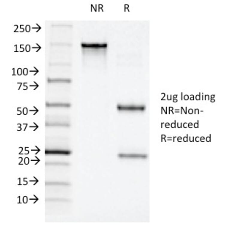 SDS-PAGE - Anti-CD11c Antibody [ITGAX/1243] - BSA and Azide free (A252253) - Antibodies.com