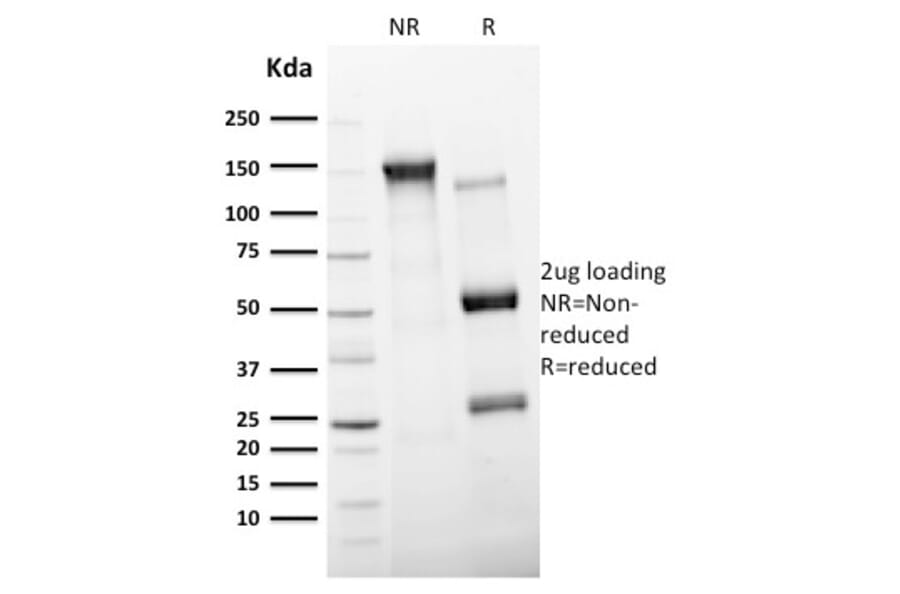 SDS-PAGE - Anti-CD11c Antibody [ITGAX/2507] - BSA and Azide free (A252255) - Antibodies.com