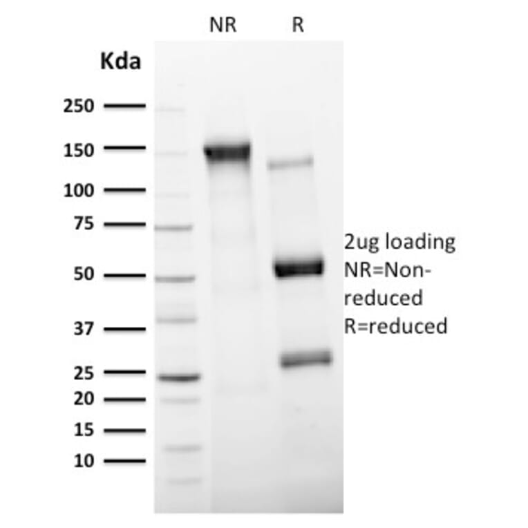 SDS-PAGE - Anti-CD11c Antibody [ITGAX/2507] - BSA and Azide free (A252255) - Antibodies.com
