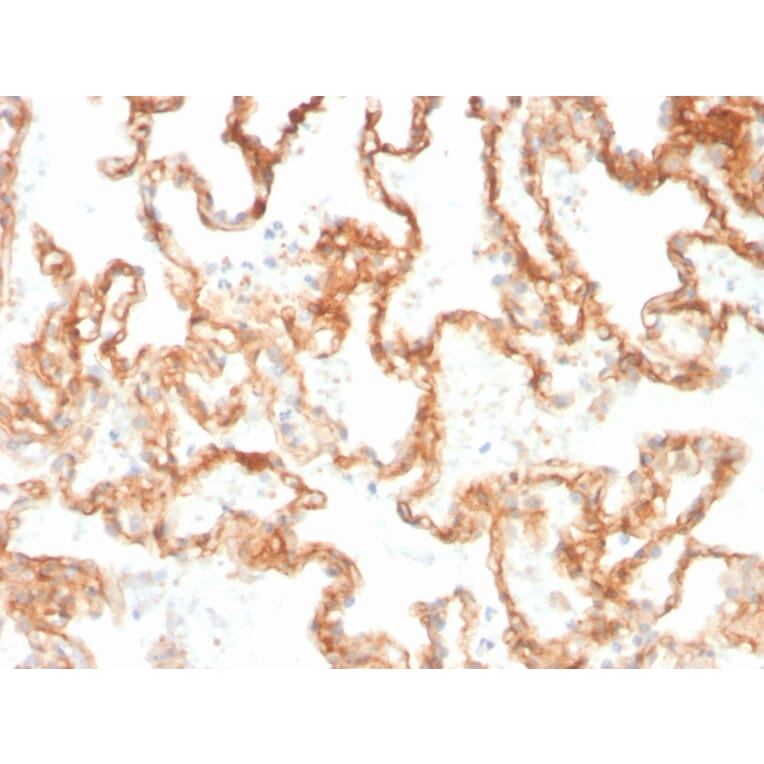 Immunohistochemistry - Anti-CD29 Antibody [ITGB1/3613] - BSA and Azide free (A252257) - Antibodies.com