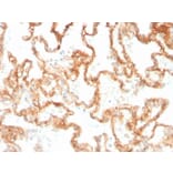 Immunohistochemistry - Anti-CD29 Antibody [ITGB1/3613] - BSA and Azide free (A252257) - Antibodies.com