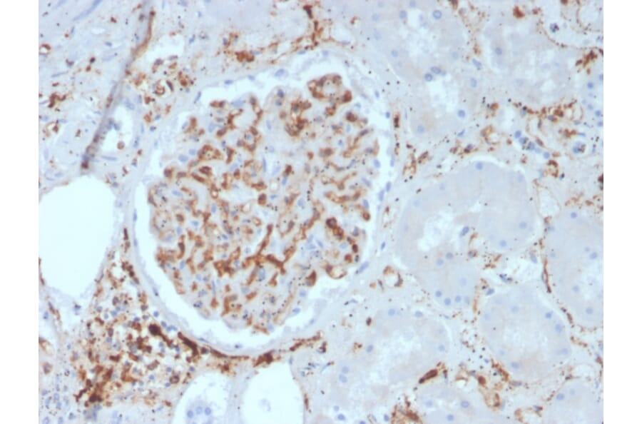 Immunohistochemistry - Anti-CD29 Antibody [ITGB1/3613] - BSA and Azide free (A252256) - Antibodies.com