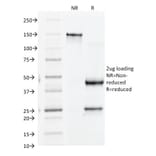 SDS-PAGE - Anti-Integrin beta 3 Antibody [Y2/51] - BSA and Azide free (A252259) - Antibodies.com