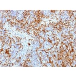 Immunohistochemistry - Anti-Integrin beta 3 Antibody [Y2/51] - BSA and Azide free (A252257) - Antibodies.com