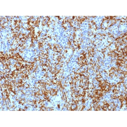 Immunohistochemistry - Anti-Integrin beta 3 Antibody [ITGB3/1713] - BSA and Azide free (A252259) - Antibodies.com