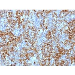 Immunohistochemistry - Anti-Integrin beta 3 Antibody [ITGB3/1713] - BSA and Azide free (A252259) - Antibodies.com