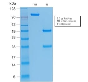 SDS-PAGE - Anti-Integrin beta 3 Antibody [rITGB3/1713] - BSA and Azide free (A252261) - Antibodies.com