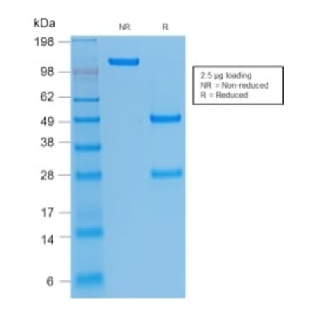 SDS-PAGE - Anti-Integrin beta 3 Antibody [rITGB3/1713] - BSA and Azide free (A252261) - Antibodies.com