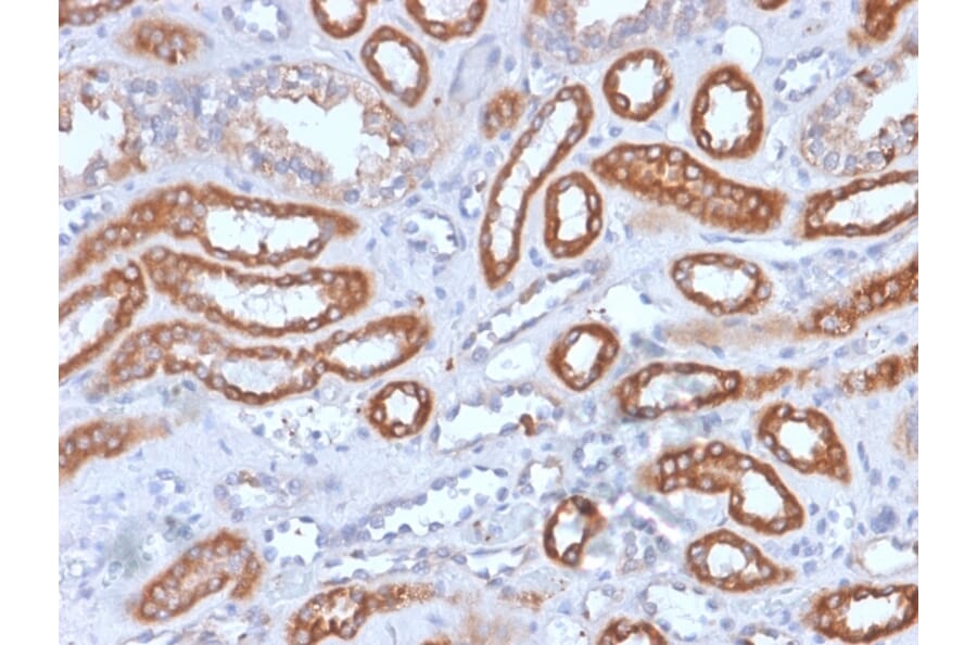 Immunohistochemistry - Anti-Integrin beta 3 Antibody [rITGB3/1713] - BSA and Azide free (A252260) - Antibodies.com