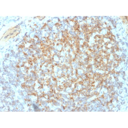 Immunohistochemistry - Anti-Integrin beta 3 Antibody [ITGB3/2145] - BSA and Azide free (A252262) - Antibodies.com