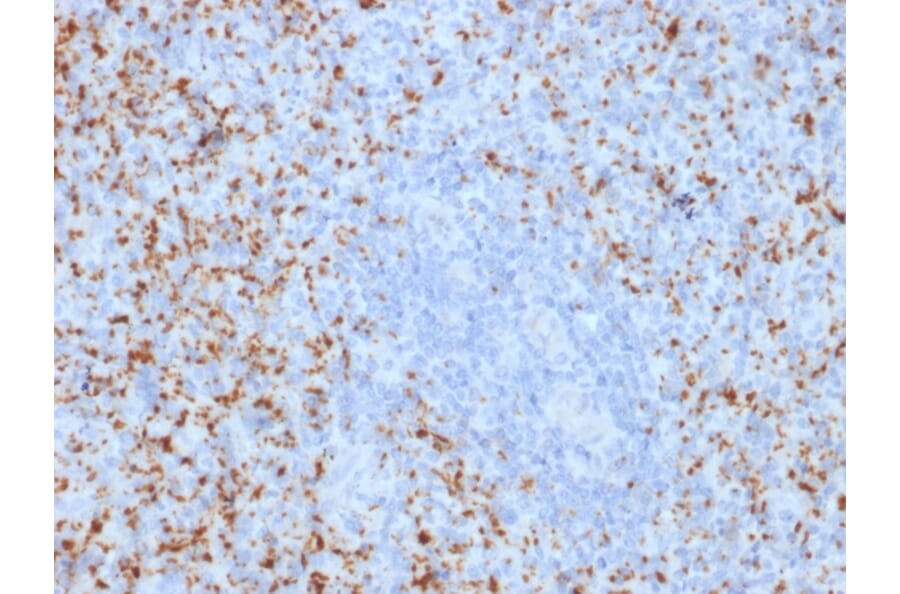 Immunohistochemistry - Anti-Integrin beta 3 Antibody [ITGB3/2145] - BSA and Azide free (A252262) - Antibodies.com
