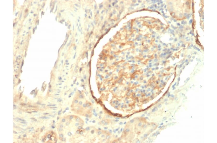 Immunohistochemistry - Anti-Integrin beta 3 Antibody [ITGB3/2145] - BSA and Azide free (A252261) - Antibodies.com