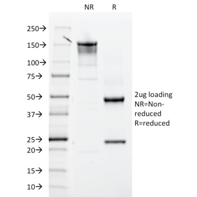 SDS-PAGE - Anti-Integrin beta 3 Antibody [ITGB3/2145] - BSA and Azide free (A252262) - Antibodies.com