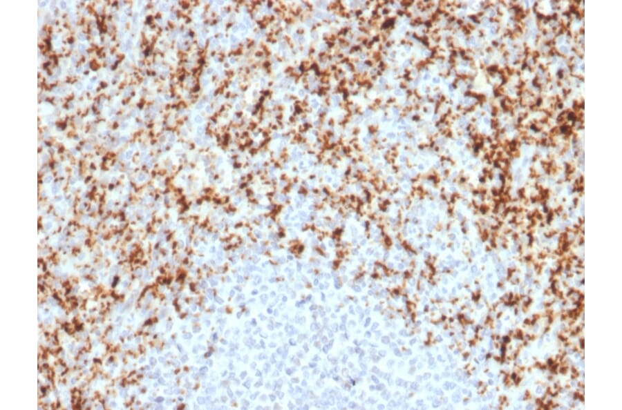 Immunohistochemistry - Anti-Integrin beta 3 Antibody [ITGB3/2597] - BSA and Azide free (A252262) - Antibodies.com