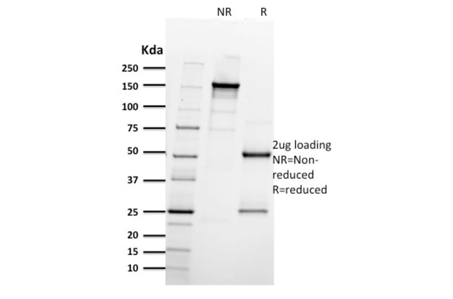 SDS-PAGE - Anti-Integrin beta 3 Antibody [ITGB3/2597] - BSA and Azide free (A252263) - Antibodies.com