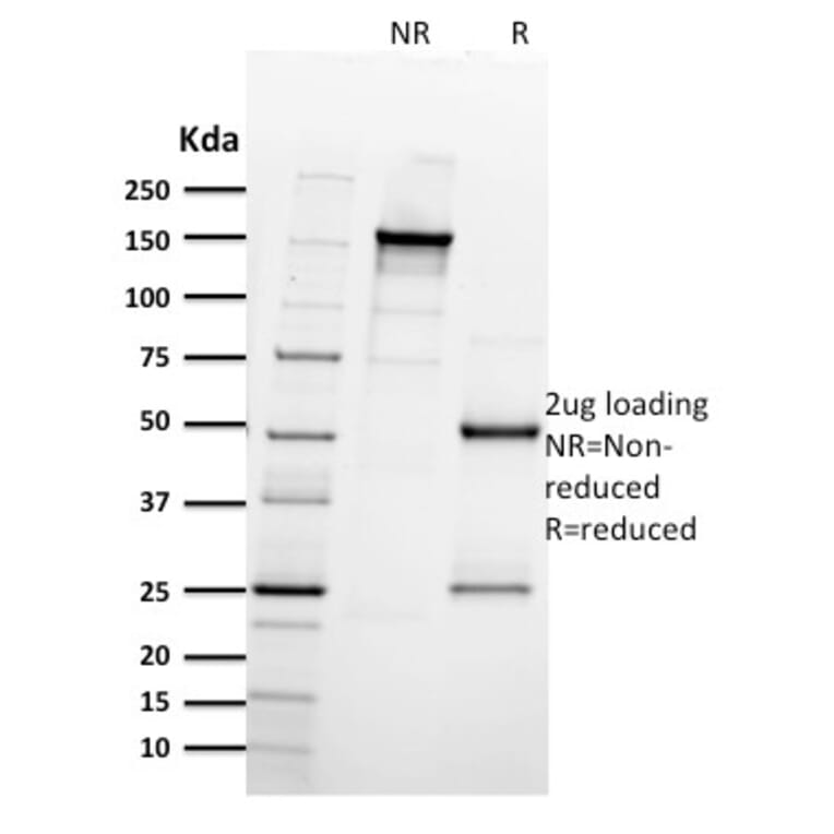 SDS-PAGE - Anti-Integrin beta 3 Antibody [ITGB3/2597] - BSA and Azide free (A252263) - Antibodies.com